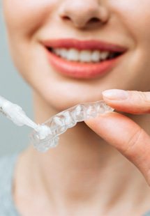 Woman applying gel to custom-fitted teeth whitening applicator