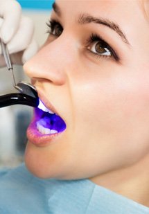 Dentist hardening patient’s tooth-colored filling with UV light