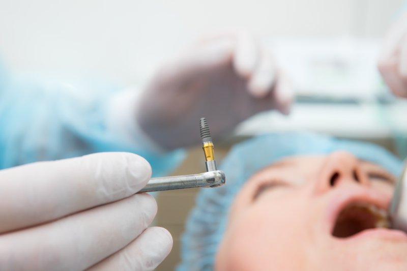 closeup of dentist holding implant post 