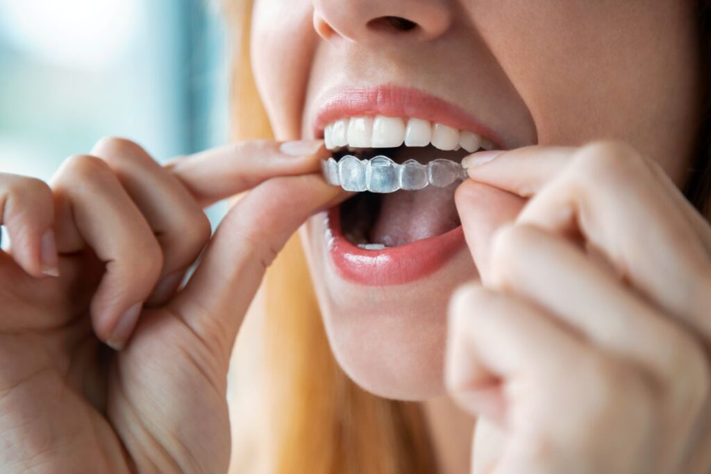 A woman putting on a clear aligner