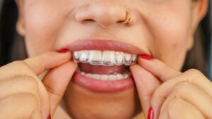 Woman putting in her Dandy Clear Aligners